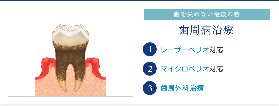 矯正歯科・マウスピース矯正